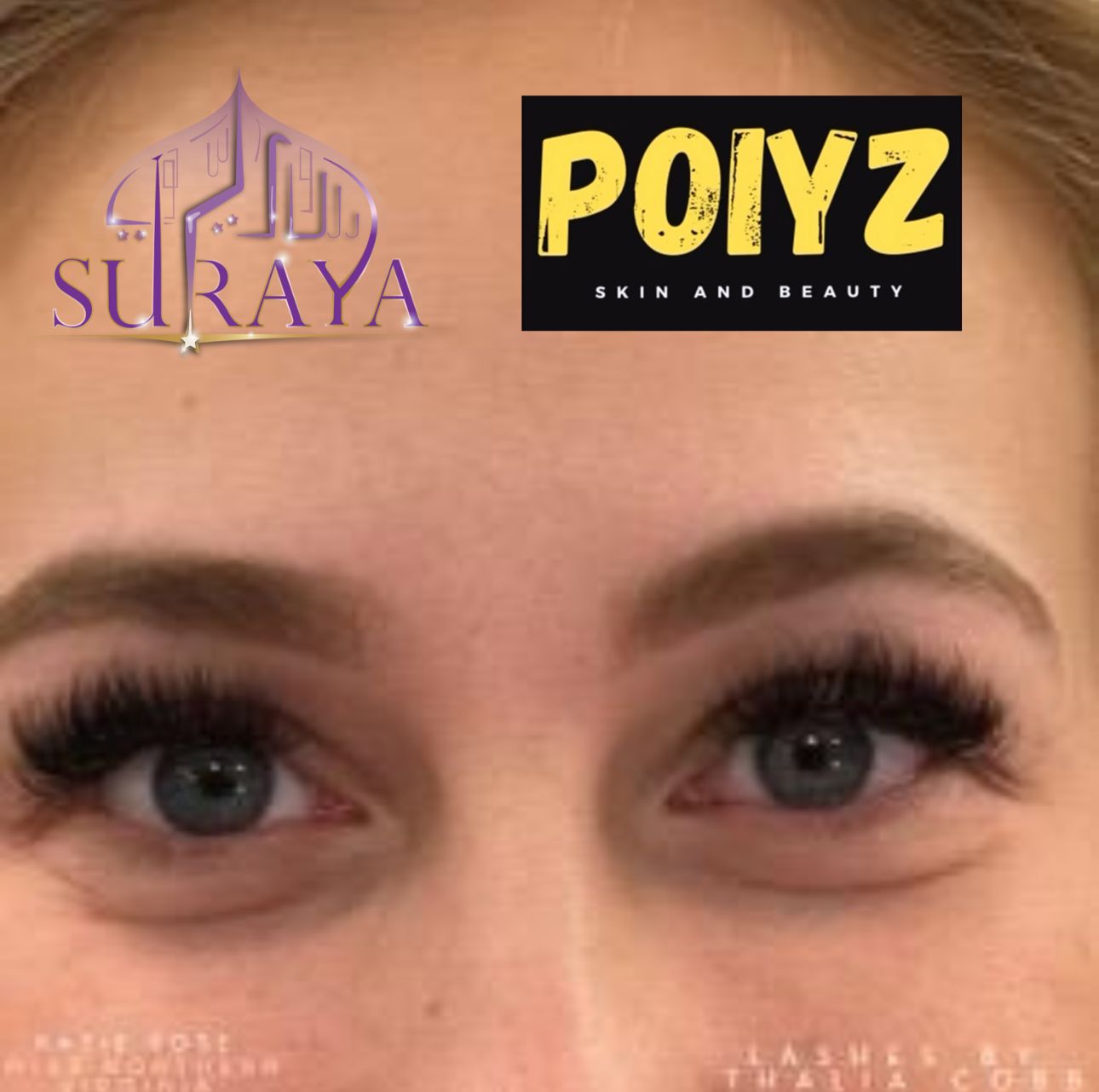 before-after-3